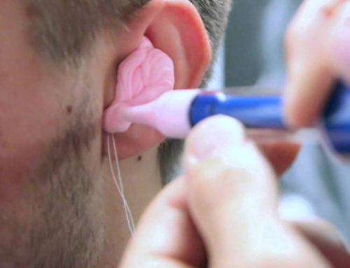 A jó hallókészülék illeszték alapja a jó mintavétel! A te audiológusod is így csinálja?